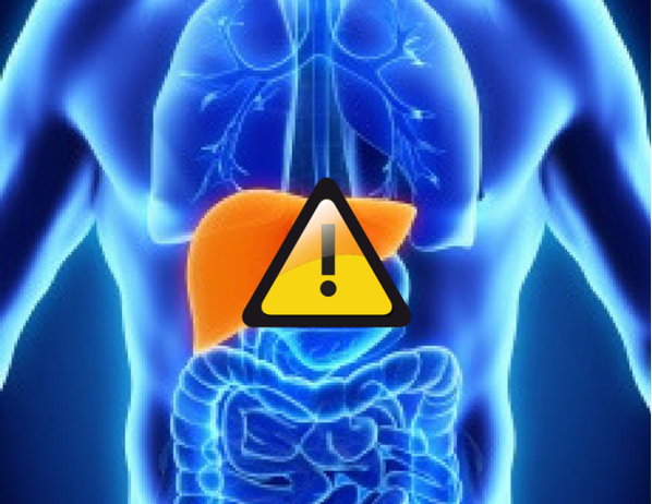 Acid Reflux Drugs Linked to Serious Liver Damage